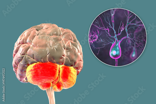 Human brain with highlighted cerebellum and close-up of Purkinje neurons, 3D illustration. Cerebellum controls balance and coordination, Purkinje cells are key neurons in motor function.