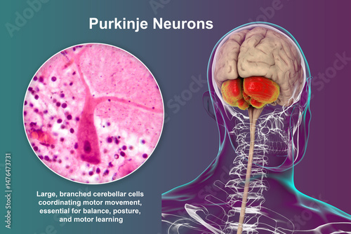 Human brain with highlighted cerebellum and close-up of Purkinje neurons, 3D illustration and light micrograph.