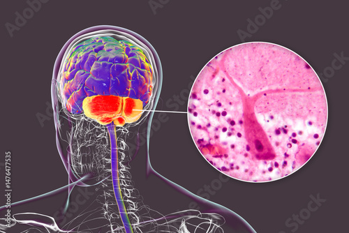 Human brain with highlighted cerebellum and close-up of Purkinje neurons, 3D illustration and light micrograph.