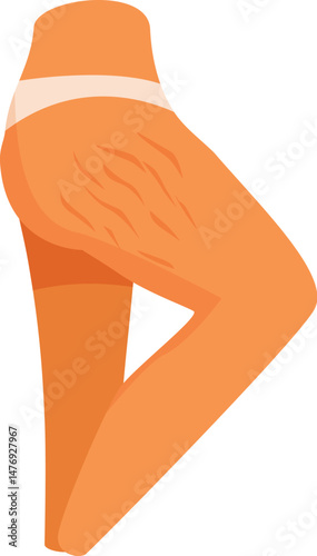Female legs with stretch marks, promoting body positivity, self acceptance, and embracing natural skin imperfections