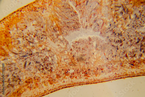 Planaria whole mount slide showing internal organs staine photo