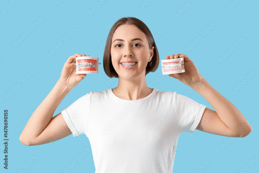 Young woman with dental braces and jaw models on blue background Young woman with dental braces and jaw models on blue background