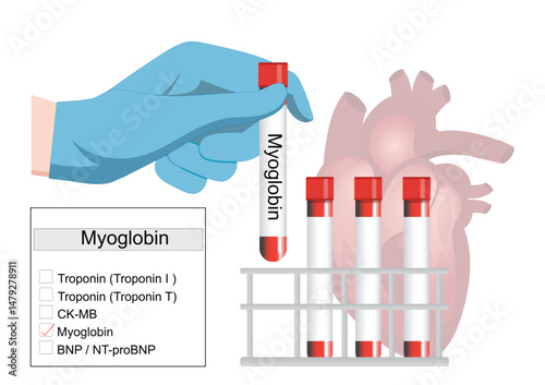 A myoglobin test is a quick.