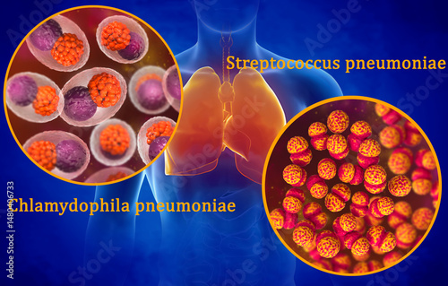 Medical background, human body with isolated respiratory system, human respiratory pathogens, Chlamydophila pneumoniae, Streptococcus pneumoniae, bacteria causing pneumonia, 3d rendering