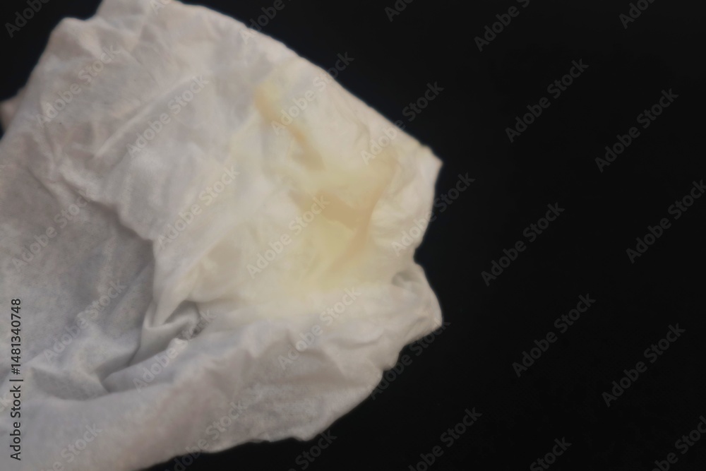 Fototapeta premium White tissue containing female cervical mucus, a sign of vaginal discharge, close up view.