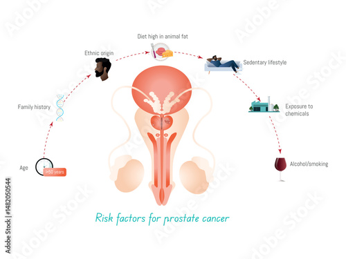 Risk factors for prostate cancer highlighting age, family history, ethnicity, diet, lifestyle and chemical exposure