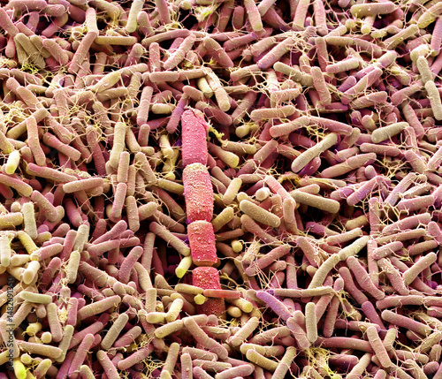 Compost bacteria, SEM