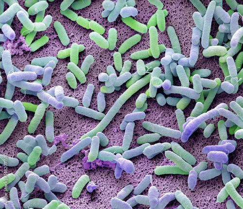 Dishcloth bacteria, SEM