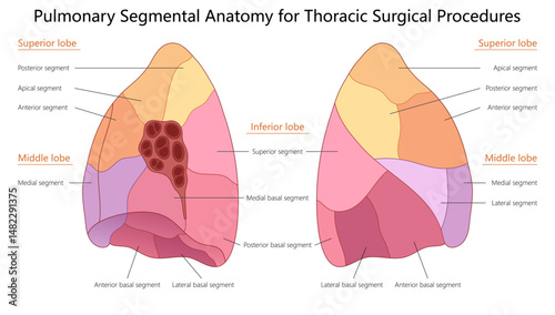pulmonary segmental anatomy, showing lobes and segments of the lungs, used for thoracic surgical procedures diagram hand drawn schematic vector illustration. Medical science educational illustration