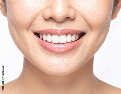 close-up of denture of laughing asian woman, shining white teeth, white background