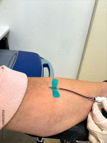 Arm of a patient whose blood is being drawn by a nurse.