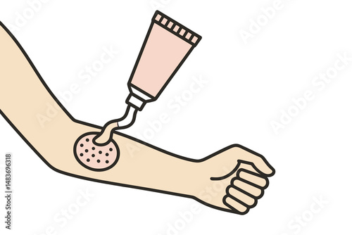 Application of cream onto skin with eczema patch on arm