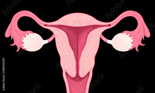 Illustrated female reproductive system with pink uterus and fallopian tubes on black background