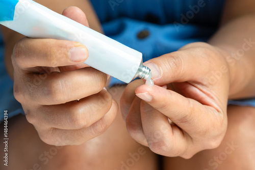 Man's hand. Apply topical steroids. Pain relief from muscle inflammation, medical concept.	
