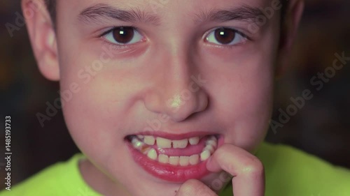 A boy rocks a baby tooth in close-up