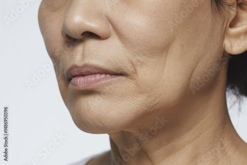 肌のトラブル 日本人女性 クローズアップ（スキンケア シミ 二キビ 赤み たるみ ゆるみ ）