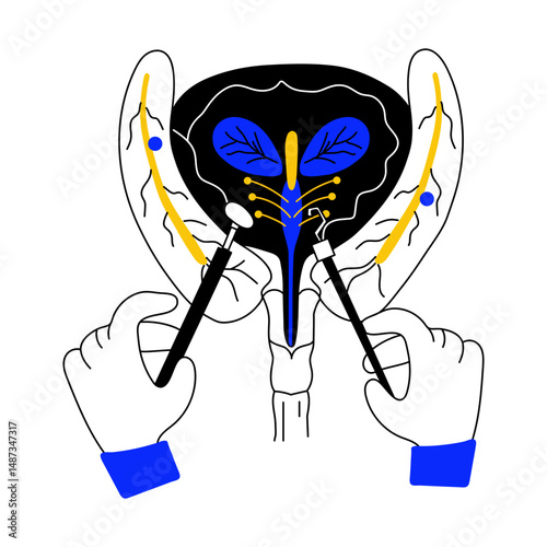 A doodle style illustration showing bladder surgery

