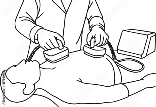 Defibrillation procedure to treat cardiac arrhythmias