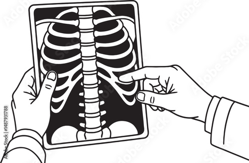 Doctor's hands holding an X-Ray of Lung