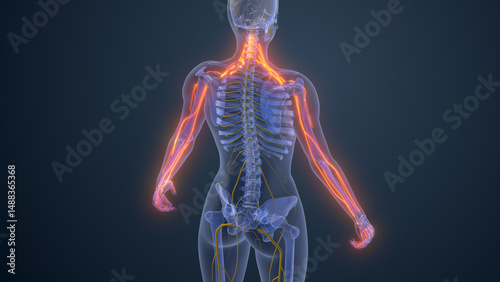 Brachialgia or Cervical radiculopathy medical concept