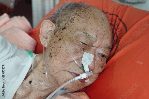 Elderly patient. photo
