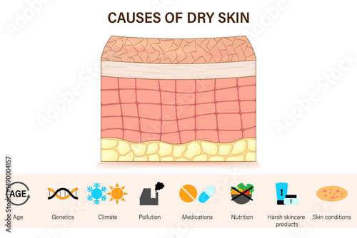 Causes of dry skin.Dry and damaged skin layer. Vector for advertising about beauty and medical treatment.