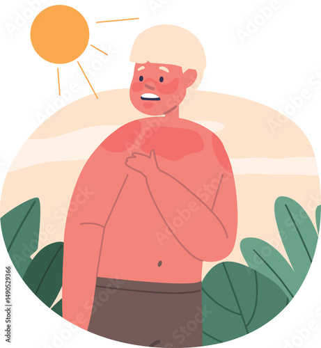 Boy with body sunburn damage