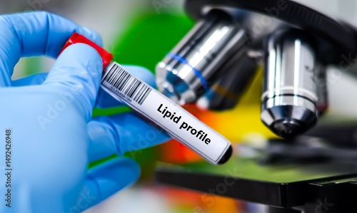 Tableau sur toile Blood sample tube for lipid profile test analysis.