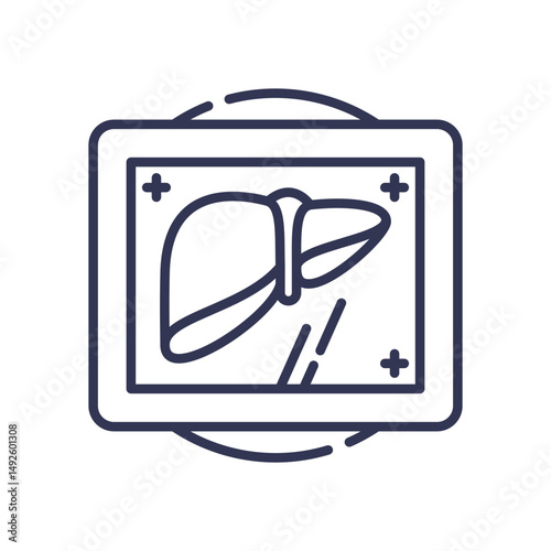 Line art of a liver on a digital screen, symbolizing medical imaging and visualization.