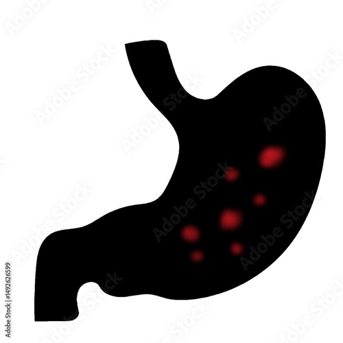 stomach ulcer silhouette illustration useful for educational and healthcare industry projects.eps