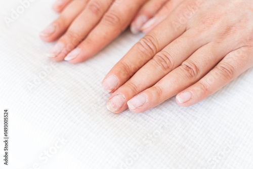 Damaged fingernails from gel polish. Hand care. Nail health. Free space.