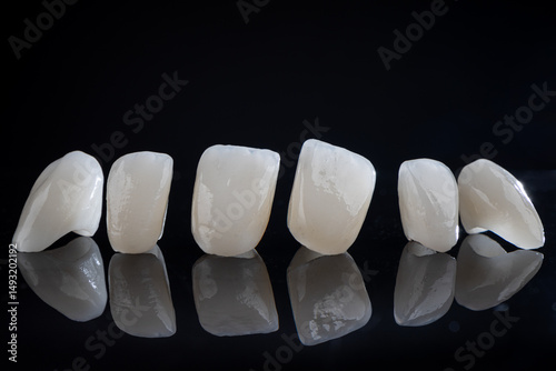 Ceramic dentures and crowns on black background. Dental health care. Ceramic zirconium in final version.