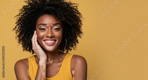 Young black woman with vitiligo smiling against a yellow background