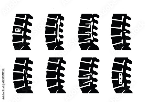 Spine health silhouette icons set. vertebrae and spinal treatment symbols