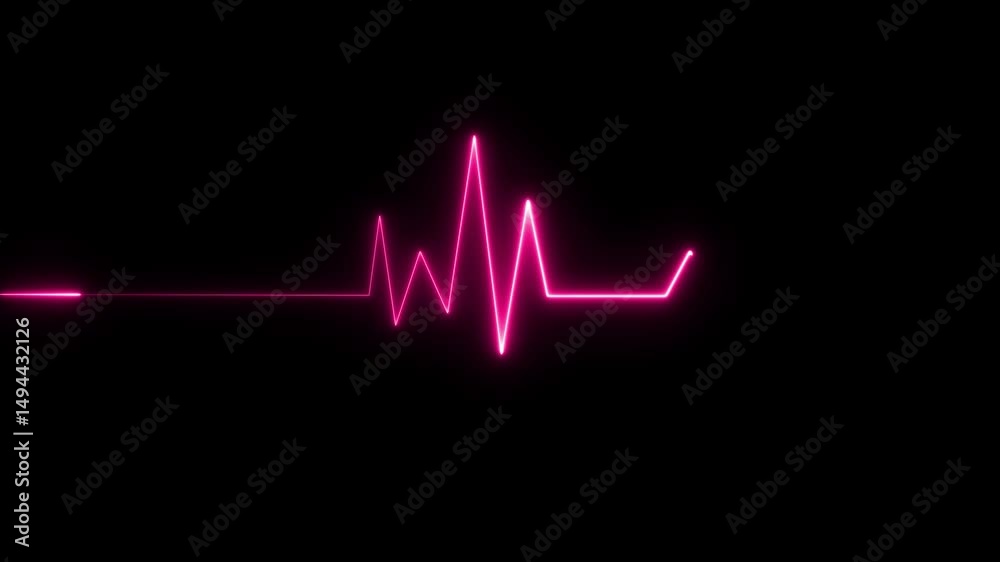 animation of an ecg ekg display. Heart Rate Monitor Electrocardiogram Ekg Or Ecg looping background. Electrocardiogram with a heart rate monitor animation.