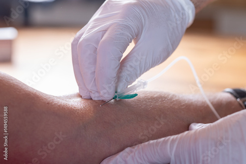 Slika na platnu Gloved hands inserting IV needle into patient’s arm
