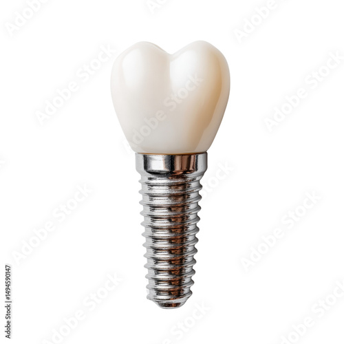 A single dental implant with a ceramic crown is displayed against a plain background offe a clear view of restorative dentistry advancements available today.