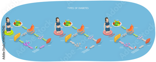 Wallpaper Mural 3D Isometric Flat  Illustration of Types Of Diabetes, Medical Scheme Torontodigital.ca