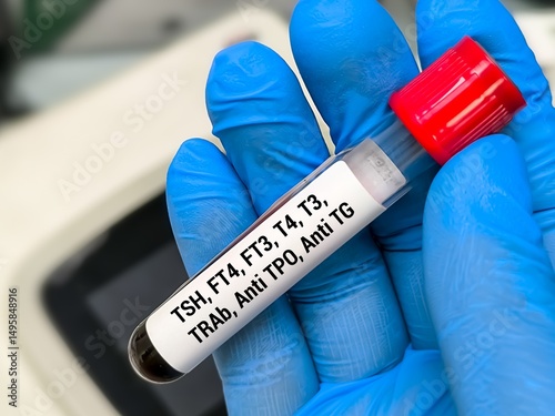 Blood sample for Thyroid panel test including TSH, FT4, FT3, T3, T4, Anti TPO, Anti TG, TR-Ab