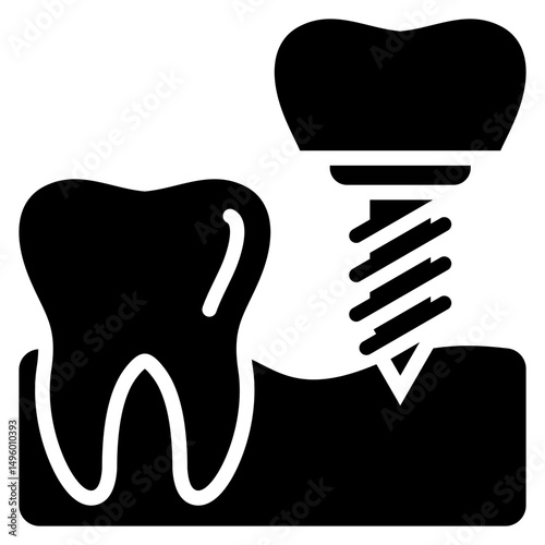 Dental Implant Icon