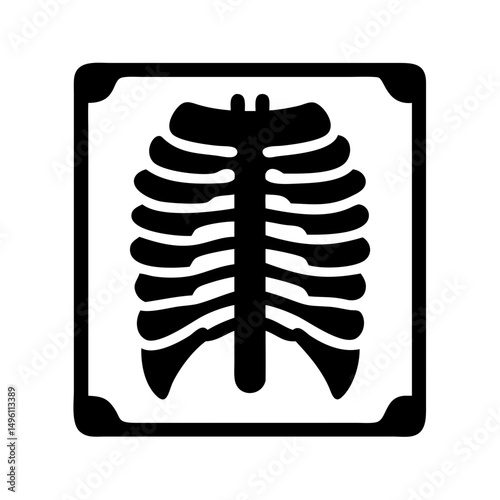 Chest x ray image for medical diagnosis and healthcare concept of human rib cage anatomy scan film