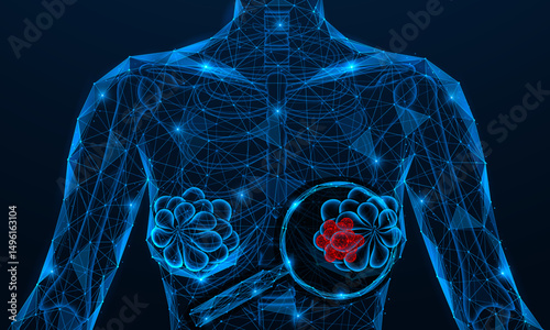 Detection of breast cancer. A tumor under a magnifying glass. Polygonal design of interconnected elements. Blue background.