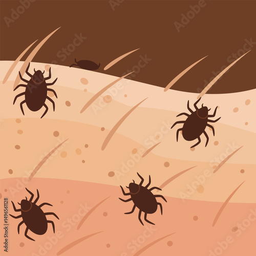 Mites Crawling on Skin with Hair Strands Medical Illustration