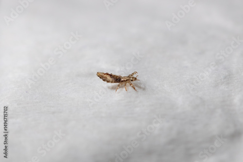 Fotografie children's bug, ectoparasite, parasitic, itch, scalp, hygiene, infestation, scho