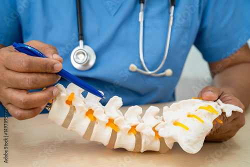 Doctor with lumbar vertebra bone skeleton and nerve model for treatment in the orthopedic department.