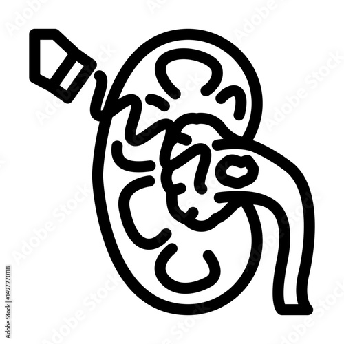 lithotripsy urology line icon vector illustration