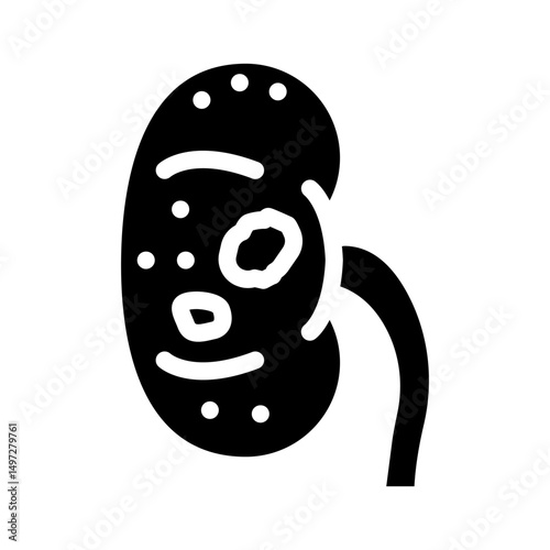urolithiasis urology glyph icon vector illustration