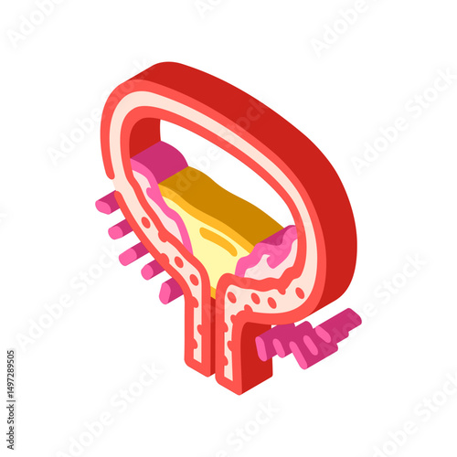 cystitis urology isometric icon vector illustration