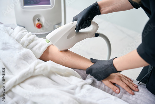 Close up of cosmetologist receiving laser epilation treatment for male hand