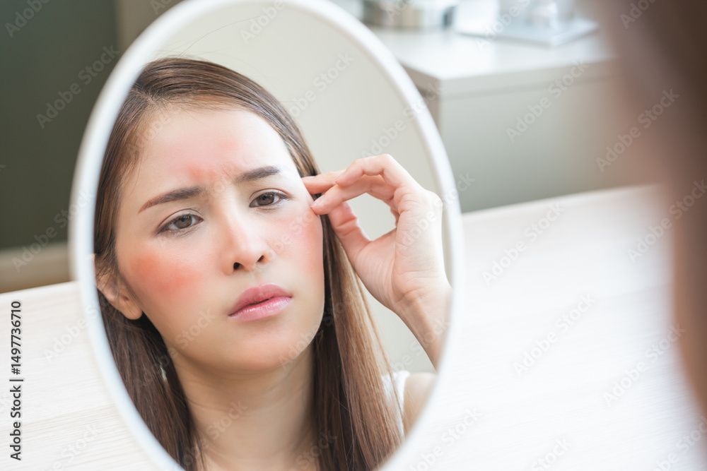 Naklejka premium Dermatology, scratch asian young woman looking at mirror, expression worry and itch, itchy allergy or allergic sensitive reaction, red spot or rash on her face. Beauty care from skin problem treatment